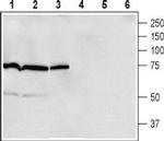 beta 1-Adrenergic Receptor (extracellular) Antibody in Western Blot (WB)