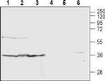 C5aR1 (extracellular) Antibody in Western Blot (WB)