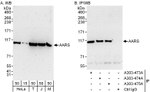 AARS Antibody in Western Blot (WB)