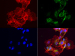 ABAT Antibody in Immunocytochemistry (ICC/IF)