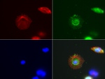 ABAT Antibody in Immunocytochemistry (ICC/IF)