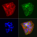 ABAT Antibody in Immunocytochemistry (ICC/IF)