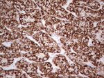 ABAT Antibody in Immunohistochemistry (Paraffin) (IHC (P))