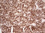 ABAT Antibody in Immunohistochemistry (Paraffin) (IHC (P))