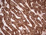 ABAT Antibody in Immunohistochemistry (Paraffin) (IHC (P))