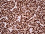 ABAT Antibody in Immunohistochemistry (Paraffin) (IHC (P))