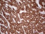 ABAT Antibody in Immunohistochemistry (Paraffin) (IHC (P))