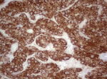 ABAT Antibody in Immunohistochemistry (Paraffin) (IHC (P))