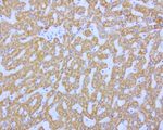 ABAT Antibody in Immunohistochemistry (Paraffin) (IHC (P))