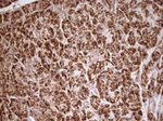 ABAT Antibody in Immunohistochemistry (Paraffin) (IHC (P))