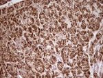 ABAT Antibody in Immunohistochemistry (Paraffin) (IHC (P))