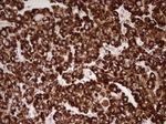 ABAT Antibody in Immunohistochemistry (Paraffin) (IHC (P))