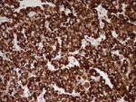 ABAT Antibody in Immunohistochemistry (Paraffin) (IHC (P))