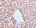 ABAT Antibody in Immunohistochemistry (Paraffin) (IHC (P))