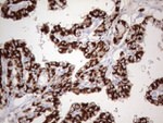 ABAT Antibody in Immunohistochemistry (Paraffin) (IHC (P))