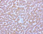 ABAT Antibody in Immunohistochemistry (Paraffin) (IHC (P))