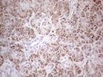 ABAT Antibody in Immunohistochemistry (Paraffin) (IHC (P))