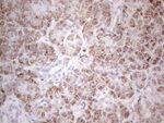 ABAT Antibody in Immunohistochemistry (Paraffin) (IHC (P))