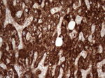 ABAT Antibody in Immunohistochemistry (Paraffin) (IHC (P))