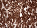 ABAT Antibody in Immunohistochemistry (Paraffin) (IHC (P))