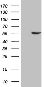 ABAT Antibody in Western Blot (WB)