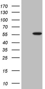 ABAT Antibody in Western Blot (WB)