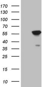 ABAT Antibody in Western Blot (WB)