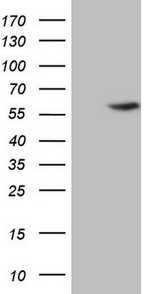 ABAT Antibody in Western Blot (WB)