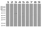 ABAT Antibody in Western Blot (WB)