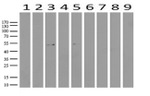 ABAT Antibody in Western Blot (WB)