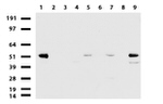 ABAT Antibody in Western Blot (WB)