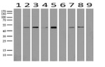 ABAT Antibody in Western Blot (WB)