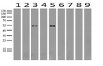 ABAT Antibody in Western Blot (WB)