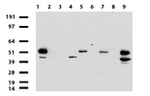 ABAT Antibody in Western Blot (WB)