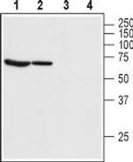 Bestrophin-1 (extracellular) Antibody in Western Blot (WB)