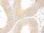 ABC50 Antibody in Immunohistochemistry (IHC)