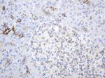 ABCB1 Antibody in Immunohistochemistry (Paraffin) (IHC (P))