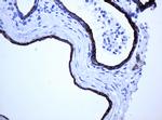 ABCB1 Antibody in Immunohistochemistry (Paraffin) (IHC (P))