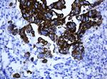 ABCB1 Antibody in Immunohistochemistry (Paraffin) (IHC (P))