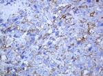 ABCB1 Antibody in Immunohistochemistry (Paraffin) (IHC (P))