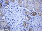 ABCB1 Antibody in Immunohistochemistry (Paraffin) (IHC (P))