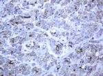 ABCB1 Antibody in Immunohistochemistry (Paraffin) (IHC (P))