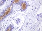 ABCB1 Antibody in Immunohistochemistry (Paraffin) (IHC (P))