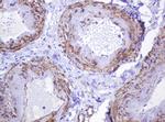 ABCB1 Antibody in Immunohistochemistry (Paraffin) (IHC (P))