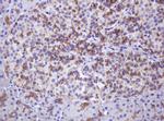 ABCB1 Antibody in Immunohistochemistry (Paraffin) (IHC (P))