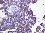 ABCB1 Antibody in Immunohistochemistry (Paraffin) (IHC (P))