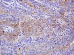 ABCB1 Antibody in Immunohistochemistry (Paraffin) (IHC (P))