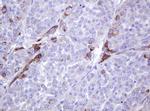 ABCB1 Antibody in Immunohistochemistry (Paraffin) (IHC (P))