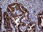 ABCB1 Antibody in Immunohistochemistry (Paraffin) (IHC (P))