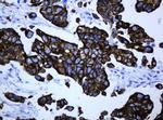 ABCB1 Antibody in Immunohistochemistry (Paraffin) (IHC (P))